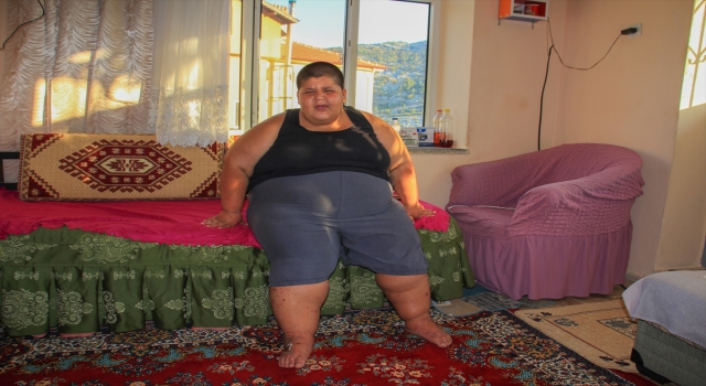 Küçük Efe, obeziteden kurtulabilmek için destek bekliyor