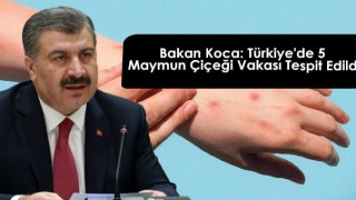 Bakan Koca: Türkiye'de 5 Maymun Çiçeği Vakası Tespit Edildi