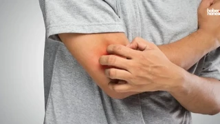Mantar Hastalığı Nedir? Mantara Karşı Doğal Çözümler!
