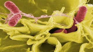 Gıda Kaynaklı Enfeksiyonlara Dikkat! Salmonella Nedir, Belirtiler ve Tedavisi Nelerdir?
